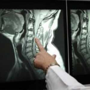 Компютърна томография на гръбначния стълб