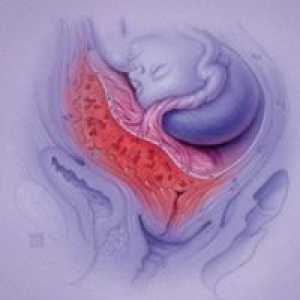 Marginal плацента превия, 20 седмици