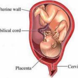 Пределно плацента превия