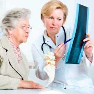 Лечение на остеопороза при възрастните жени