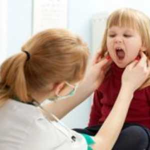 Мононуклеоза при деца - Лечение