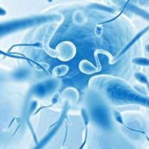 Морфологията на сперматозоидите