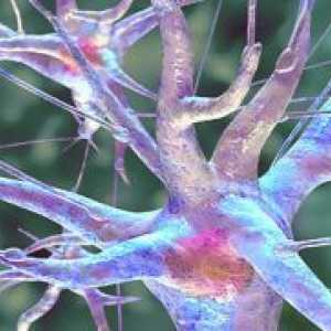 Неврит на седалищния нерв