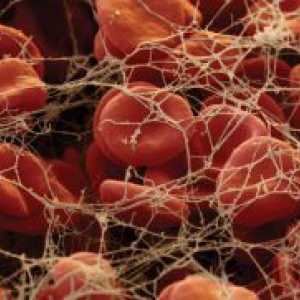 Ниските нива на тромбоцити в кръвта - причината