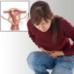 Тумор на яйчниците при жените - Лечение
