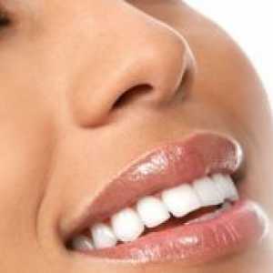 Избелване на зъбите с водороден пероксид