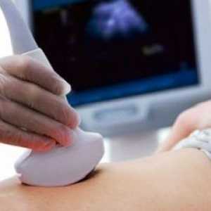 Първият ултразвук по време на бременност