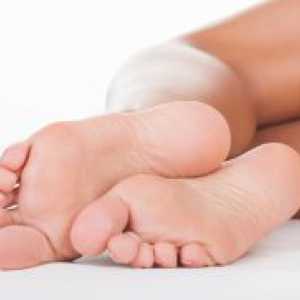 Изпотяване на краката - причини и лечение