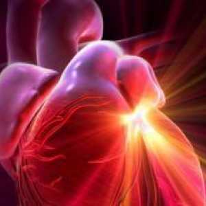 Придобити сърдечни заболявания на сърдечните клапи