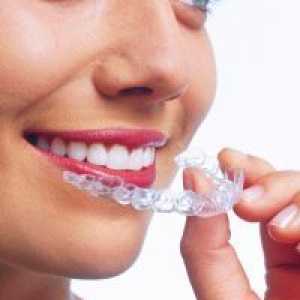 Прозрачен предпазното устройство за уста за привеждане в съответствие на зъби