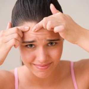 Пъпки по брадичката сред жените: Предизвиква, лечение