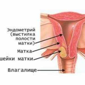 Ракът на маточната шийка - признаци