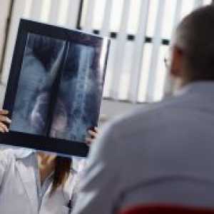 Рентгенови лъчи на стомаха с бариев - Последици