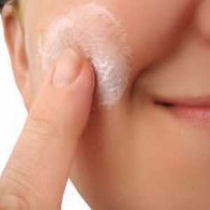 Себореен дерматит на лицето - Лечение