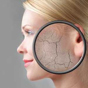 Силно лющеща се кожа на лицето: причини и лечение