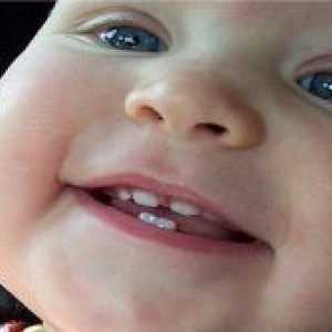 Колко мляко зъби при децата?