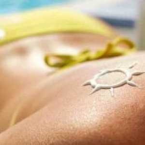 Слънчев изгаряния по кожата - лечение