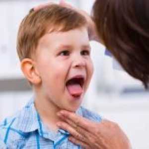 Едно дете жълт език
