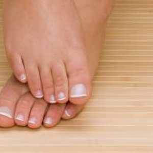 Удебеляване на ноктите на краката