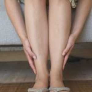 Вени на краката - Лечение
