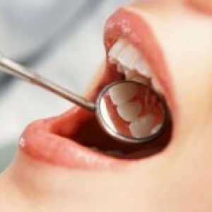 Заболяване на венците - Лечение