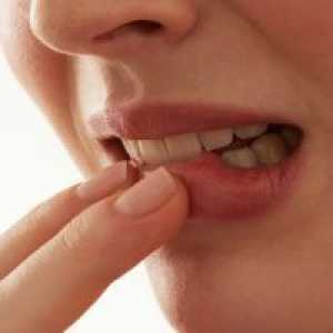 Възпаление на венците около зъба