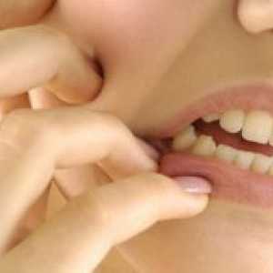 Възпаление на надкостницата на зъба