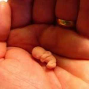 Спонтанният аборт в ранна бременност