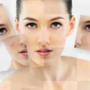 Обриви по лицето при жените - причини